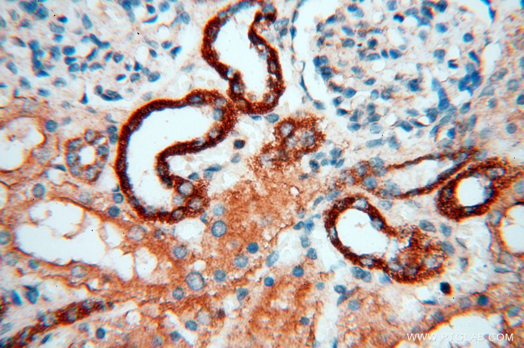 Immunohistochemistry (IHC) staining of human kidney tissue using FBXL8 Polyclonal antibody (16505-1-AP)