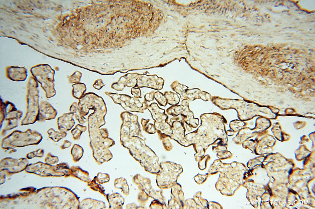 Immunohistochemistry (IHC) staining of human placenta tissue using FBXL8 Polyclonal antibody (16505-1-AP)