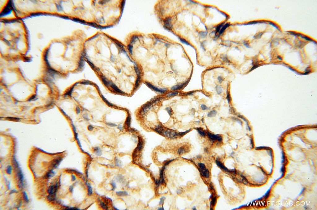 Immunohistochemistry (IHC) staining of human placenta tissue using FBXL8 Polyclonal antibody (16505-1-AP)