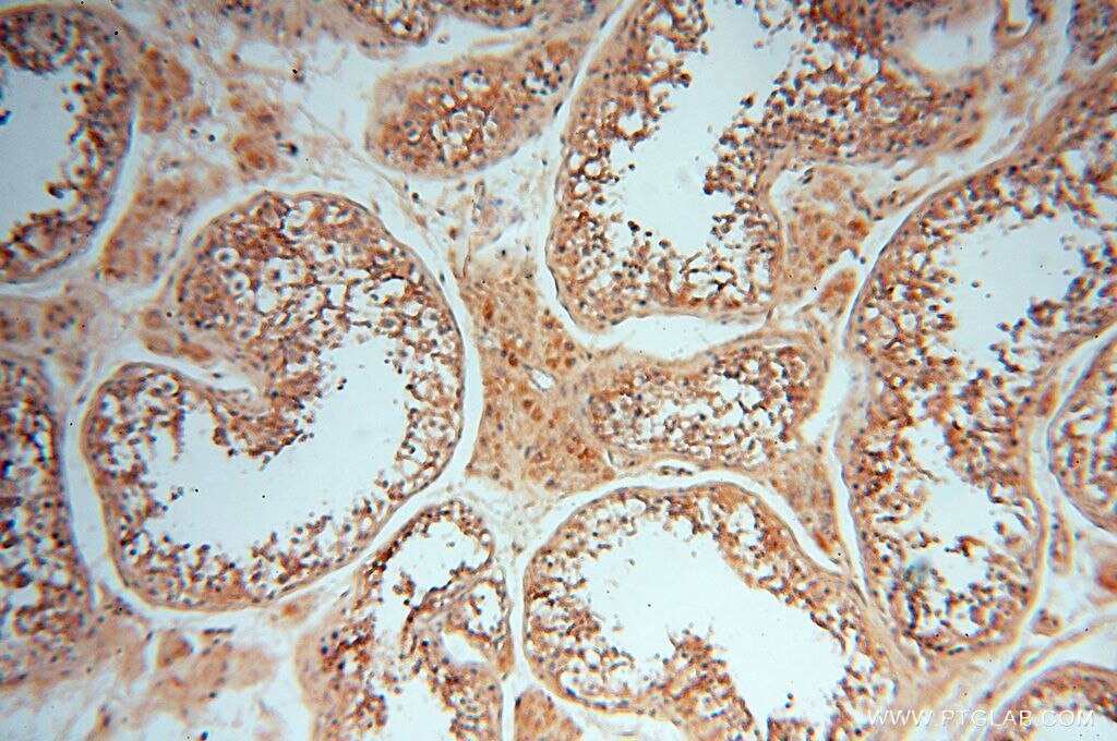 Immunohistochemistry (IHC) staining of human testis tissue using FBXL8 Polyclonal antibody (16505-1-AP)