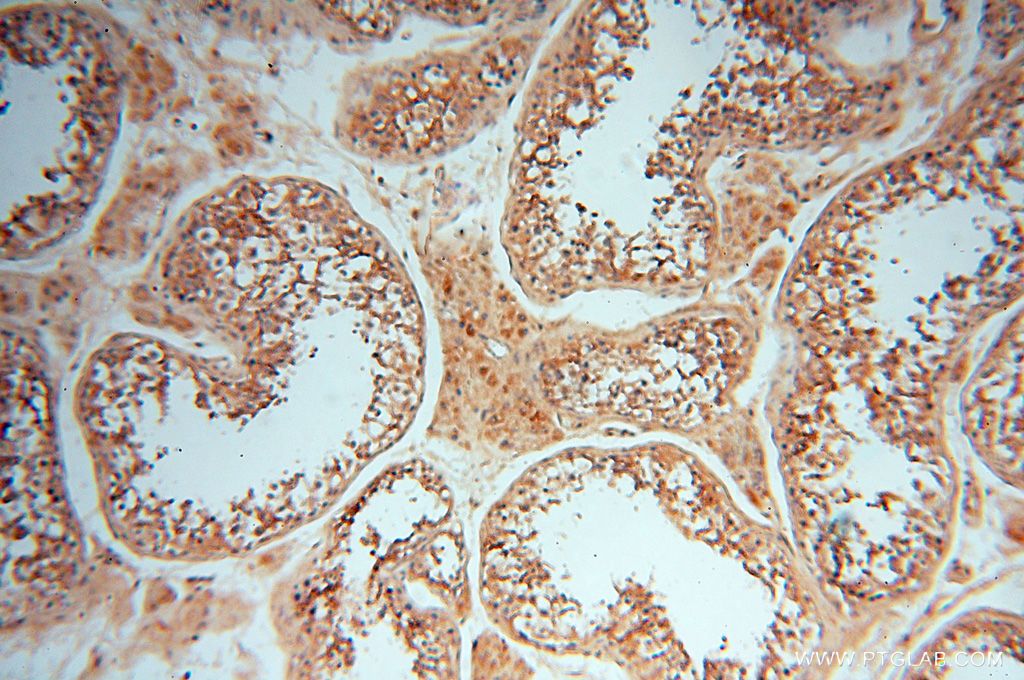 IHC staining of human testis using 16505-1-AP