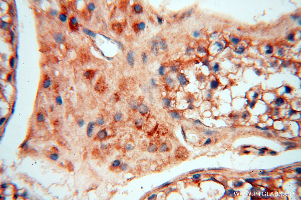 IHC staining of human testis using 16505-1-AP