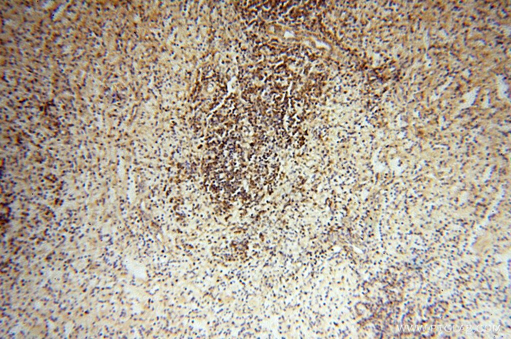 IHC staining of human spleen using 16505-1-AP