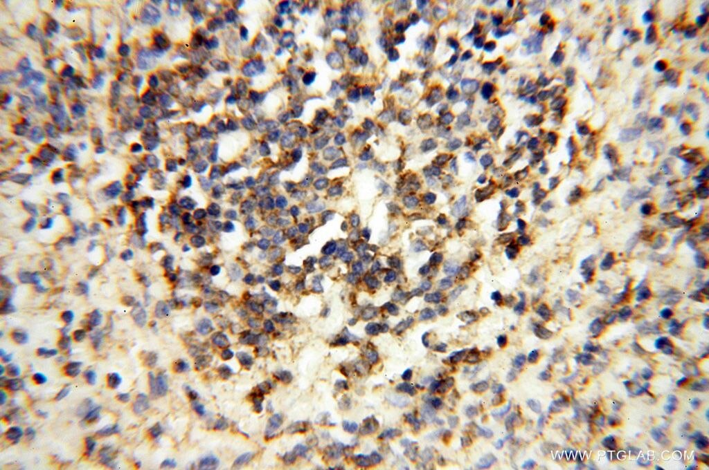 Immunohistochemistry (IHC) staining of human spleen tissue using FBXL8 Polyclonal antibody (16505-1-AP)