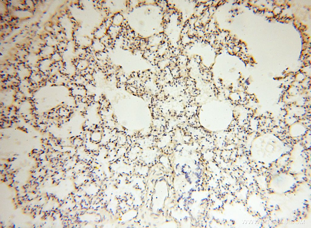 Immunohistochemistry (IHC) staining of human lung tissue using FBXL8 Polyclonal antibody (16505-1-AP)