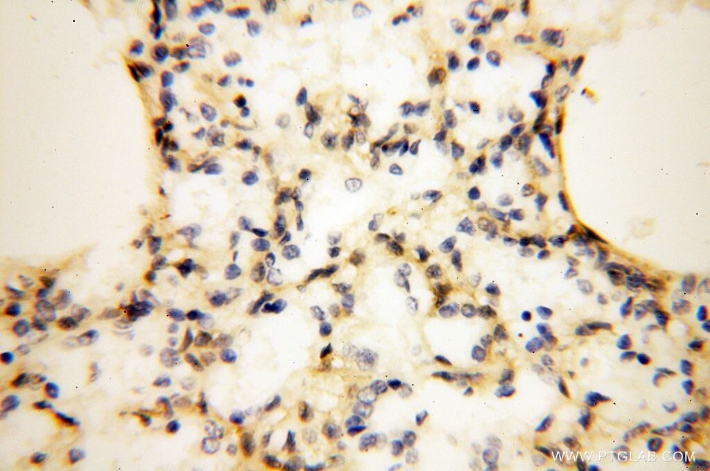 Immunohistochemistry (IHC) staining of human lung tissue using FBXL8 Polyclonal antibody (16505-1-AP)