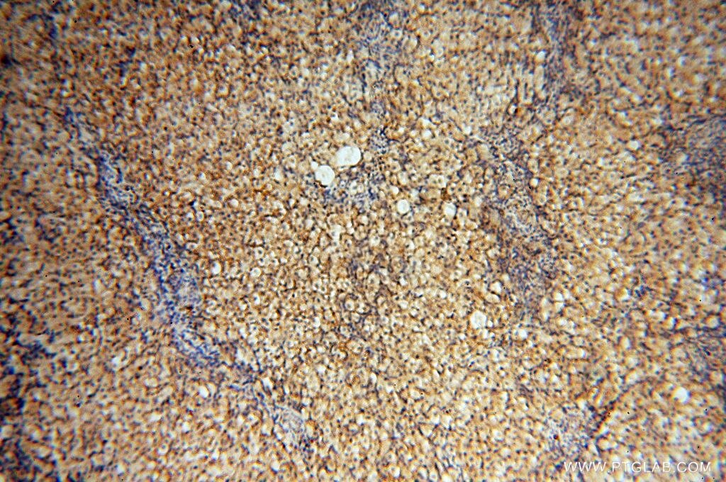 Immunohistochemistry (IHC) staining of human ovary tissue using FBXL8 Polyclonal antibody (16505-1-AP)