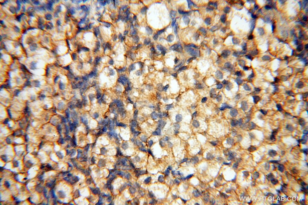 Immunohistochemistry (IHC) staining of human ovary tissue using FBXL8 Polyclonal antibody (16505-1-AP)