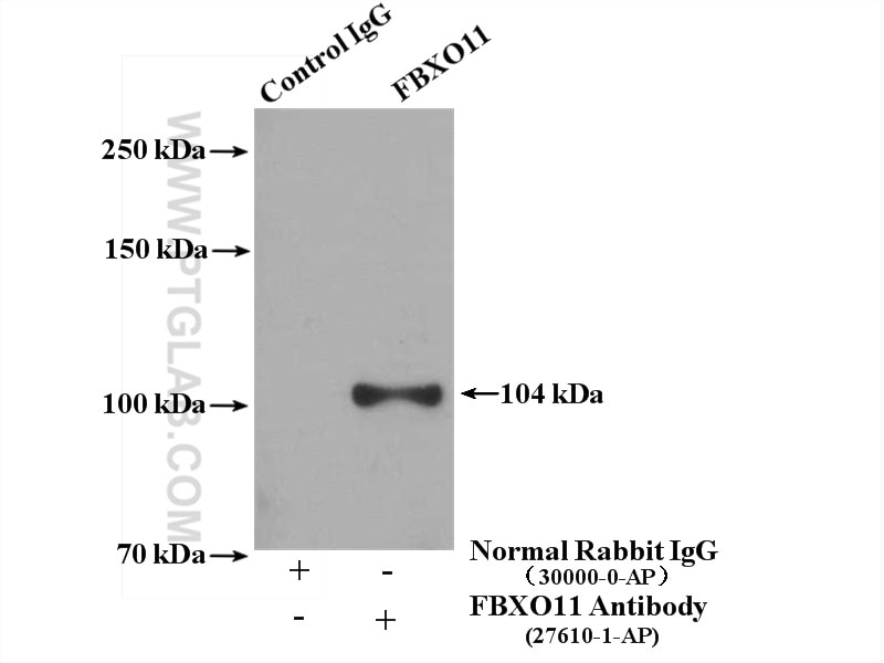 Immunoprecipitation (IP) experiment of LNCaP cells using FBXO11 Polyclonal antibody (27610-1-AP)
