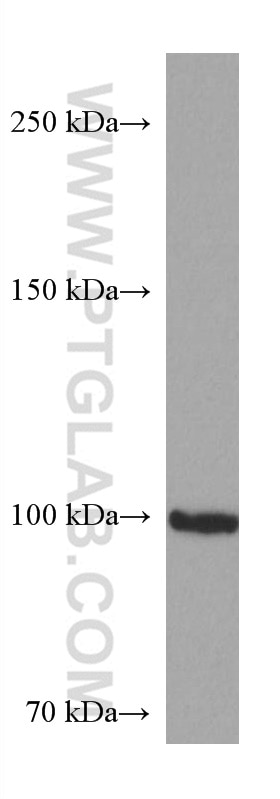 Western Blot (WB) analysis of U2OS cells using FBXO11 Monoclonal antibody (67365-1-Ig)