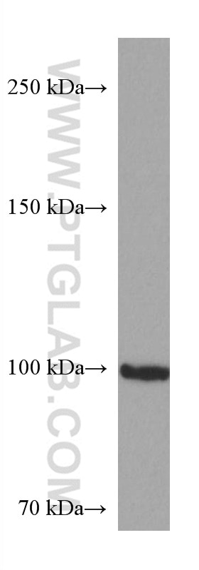 WB analysis of U2OS using 67365-1-Ig