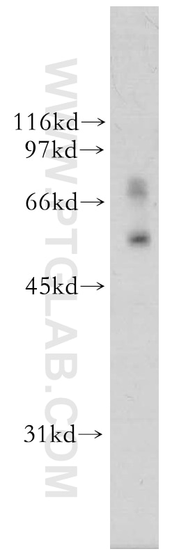 Western Blot (WB) analysis of mouse ovary tissue using FBX15 Polyclonal antibody (13024-1-AP)
