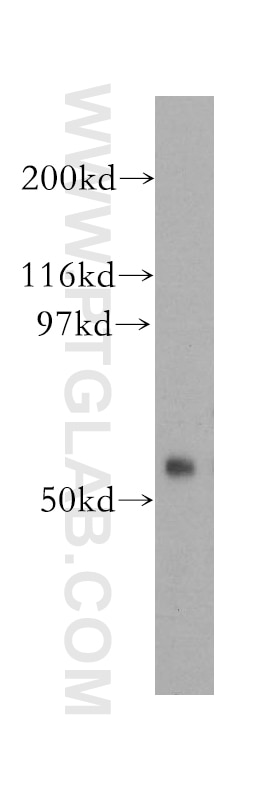 Western Blot (WB) analysis of A2780 cells using FBX15 Polyclonal antibody (13024-1-AP)