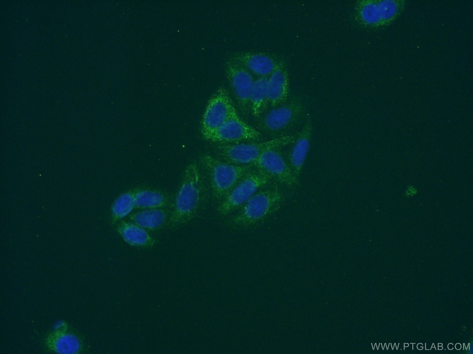 Immunofluorescence (IF) / fluorescent staining of HepG2 cells using FBXO17 Polyclonal antibody (12844-1-AP)