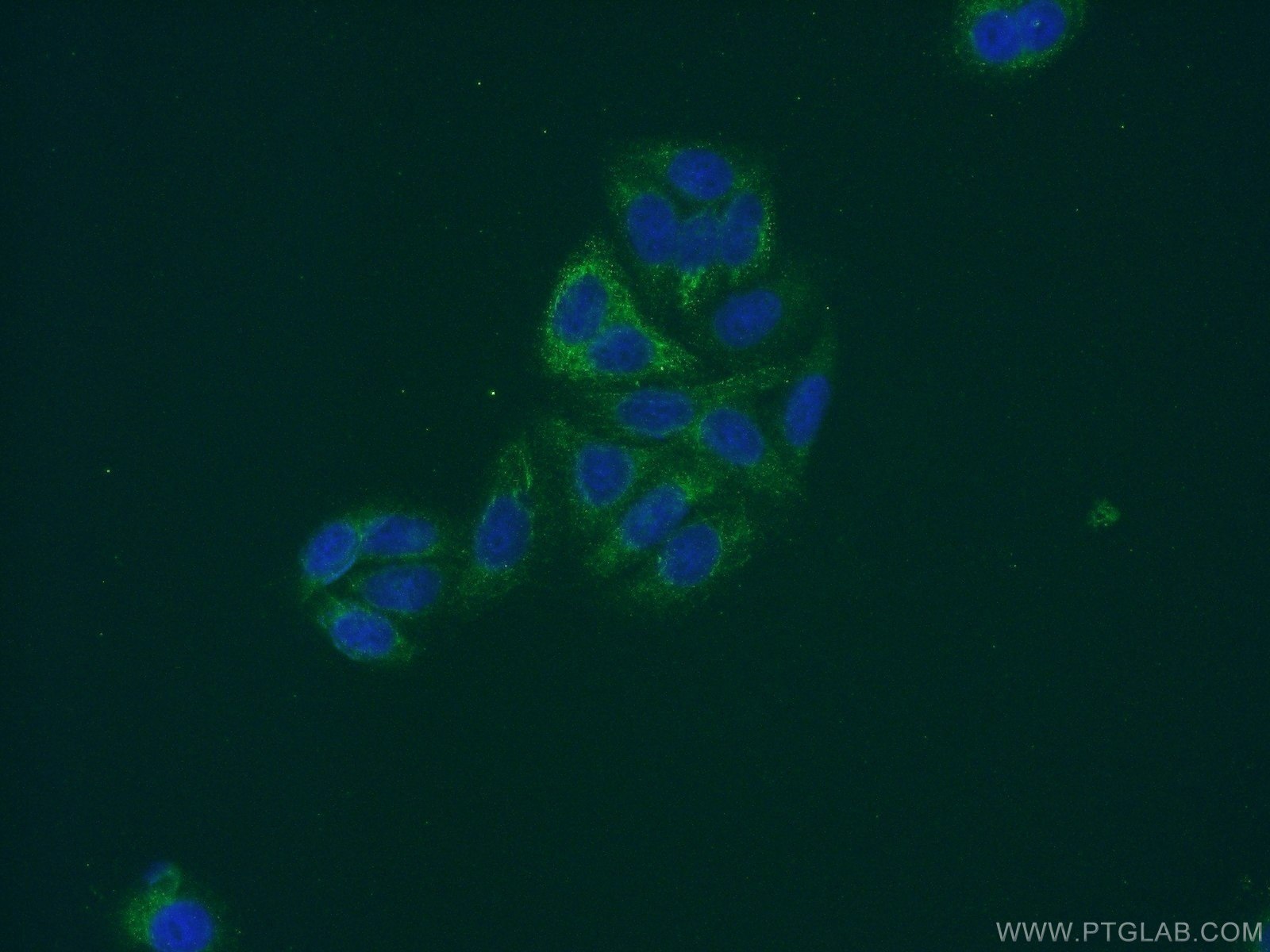 IF Staining of HepG2 using 12844-1-AP