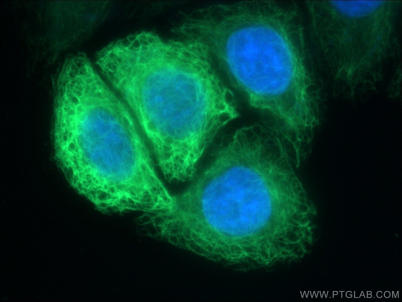 Immunofluorescence (IF) / fluorescent staining of HeLa cells using FBXO17 Polyclonal antibody (12844-1-AP)