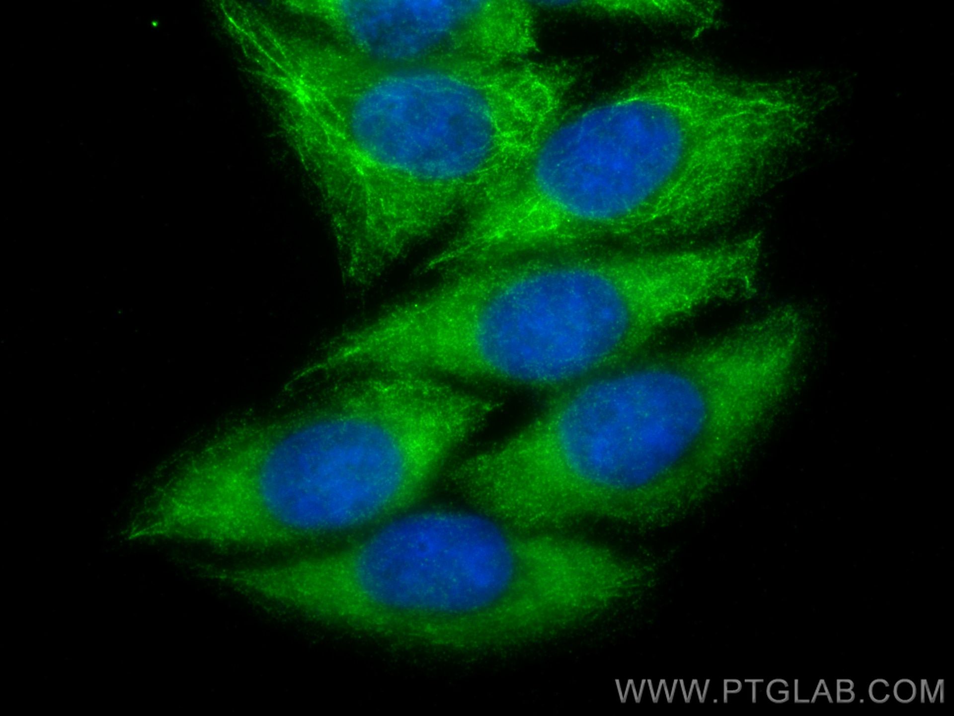 Immunofluorescence (IF) / fluorescent staining of HepG2 cells using FBXO17 Polyclonal antibody (12844-1-AP)