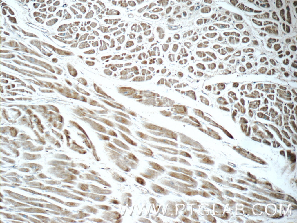 Immunohistochemistry (IHC) staining of human heart tissue using FBXO17 Polyclonal antibody (12844-1-AP)