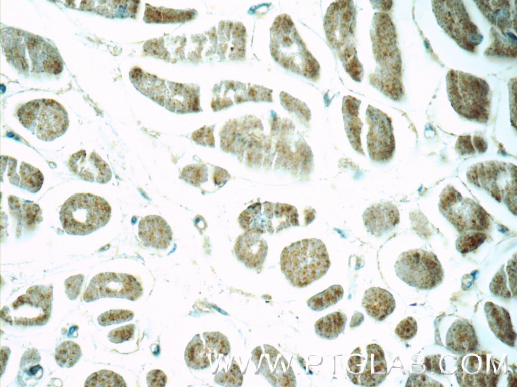 Immunohistochemistry (IHC) staining of human heart tissue using FBXO17 Polyclonal antibody (12844-1-AP)