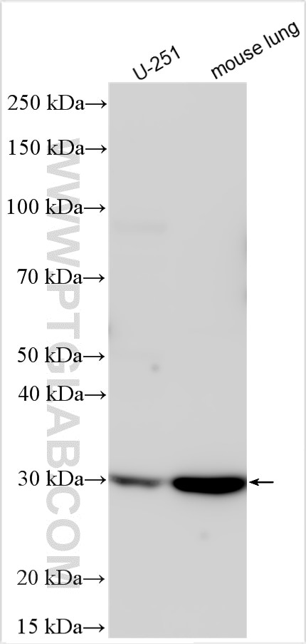 Western Blot (WB) analysis of various lysates using FBXO17 Polyclonal antibody (12844-1-AP)