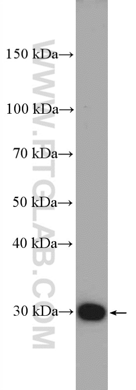 Western Blot (WB) analysis of mouse heart tissue using FBXO17 Polyclonal antibody (12844-1-AP)