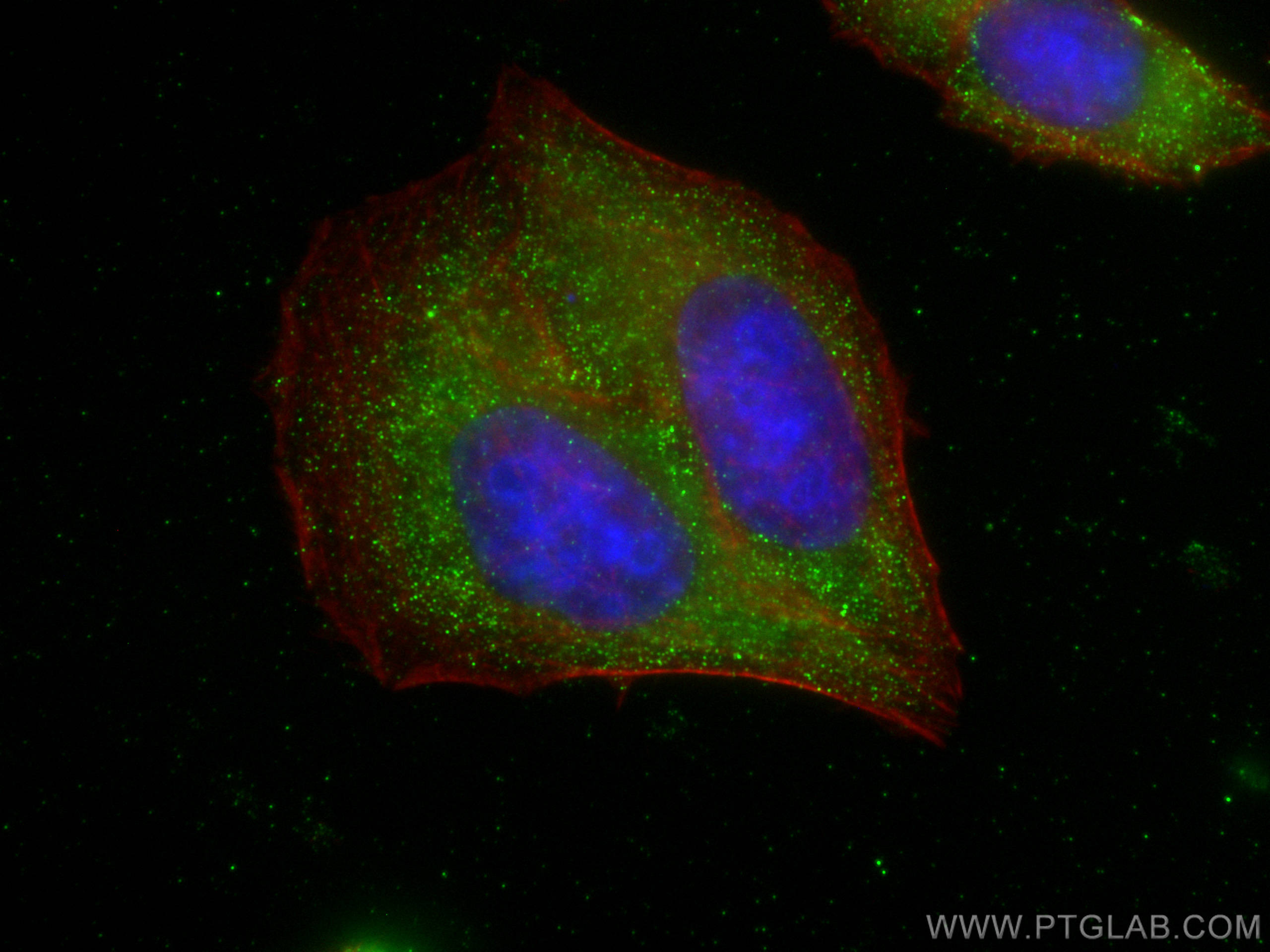 Immunofluorescence (IF) / fluorescent staining of HepG2 cells using FBXO17 Monoclonal antibody (68246-1-Ig)