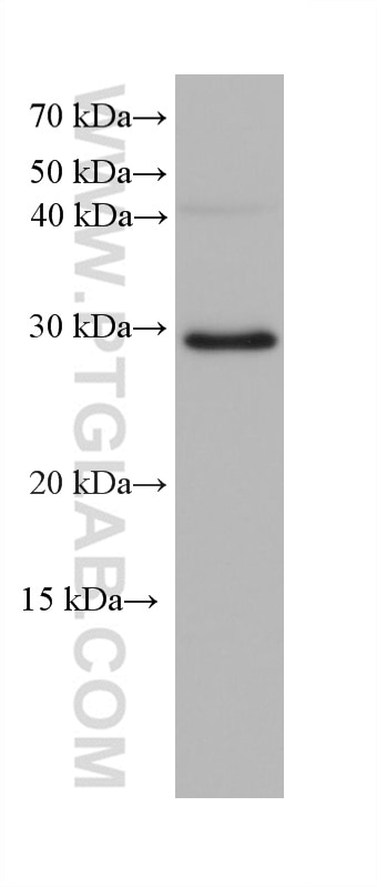 Western Blot (WB) analysis of A549 cells using FBXO17 Monoclonal antibody (68246-1-Ig)