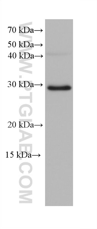 Western Blot (WB) analysis of A549 cells using FBXO17 Monoclonal antibody (68246-1-Ig)