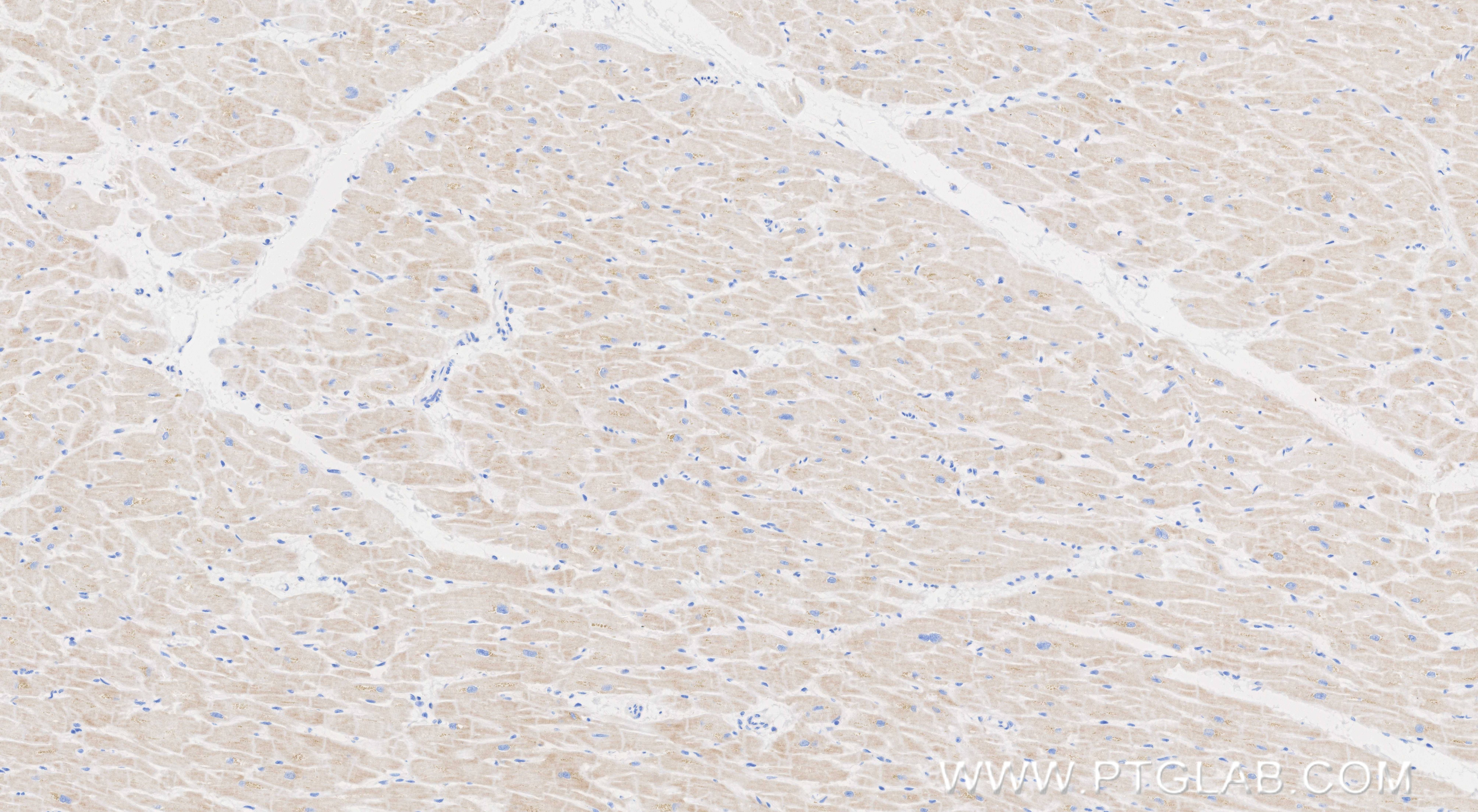 Immunohistochemical analysis of paraffin-embedded human heart tissue slide using 85936-1-RR (FBXO17 antibody) at dilution of 1:500 (under 10x lens). Heat mediated antigen retrieval with Tris-EDTA buffer (pH 9.0). Immunohistochemistry (IHC) staining of human heart tissue using FBXO17 Recombinant monoclonal antibody (85936-1-RR)