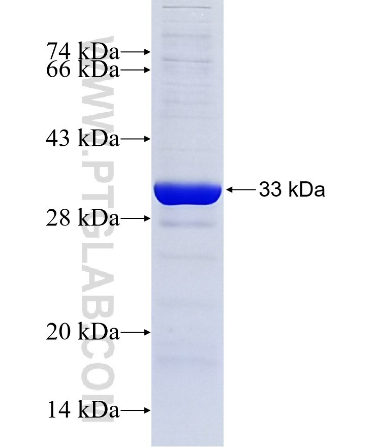 FBXO17 fusion protein Ag3867 SDS-PAGE