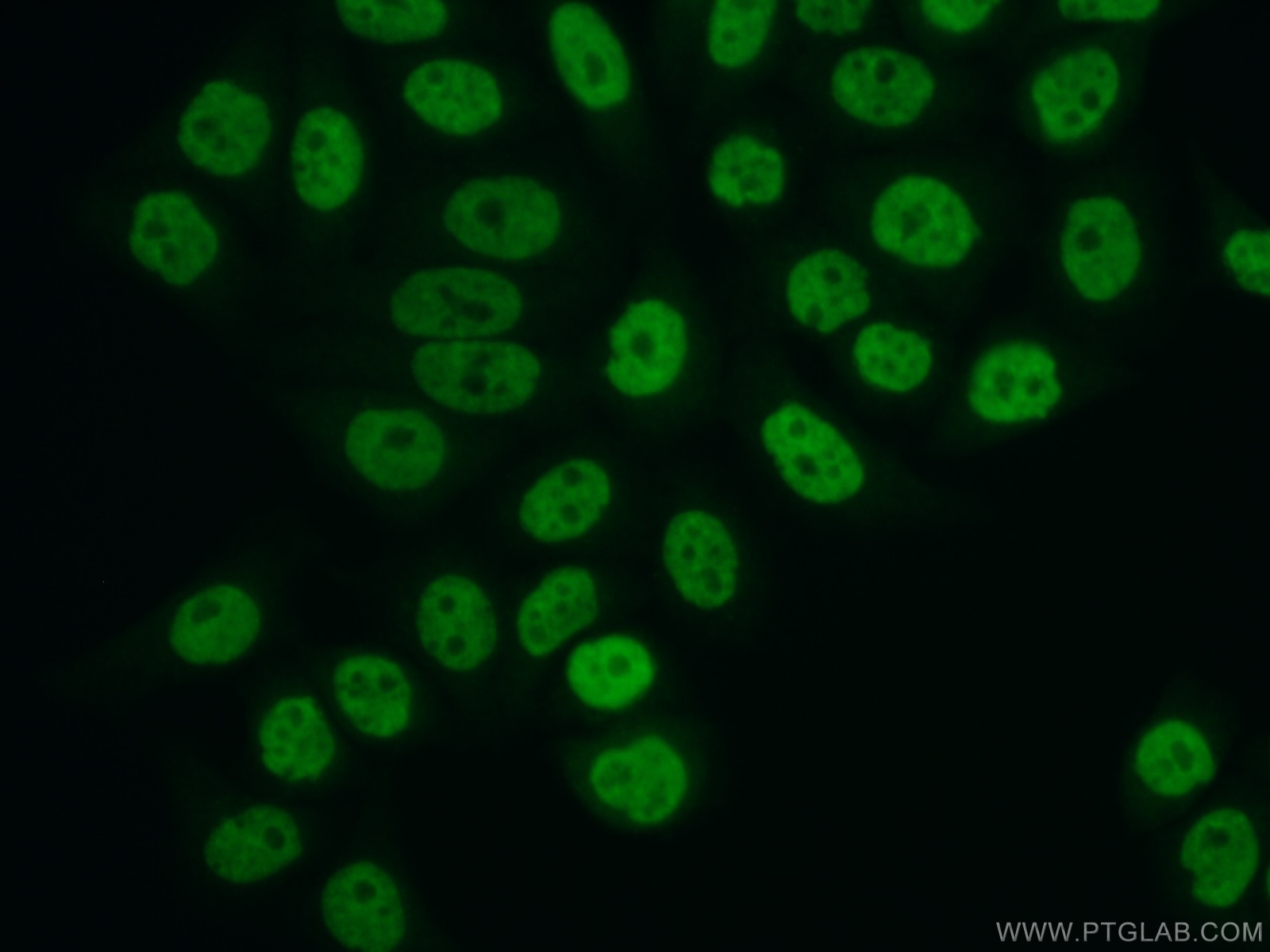 Immunofluorescence (IF) / fluorescent staining of PC-3 cells using FBXO18 Polyclonal antibody (14275-1-AP)
