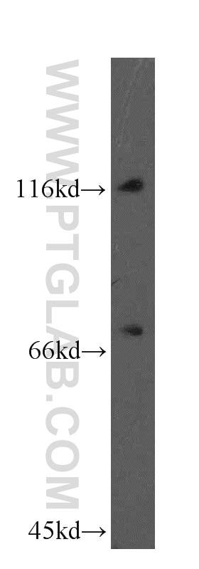 Western Blot (WB) analysis of HeLa cells using FBXO18 Polyclonal antibody (14275-1-AP)