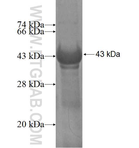 FBXO18 fusion protein Ag5622 SDS-PAGE