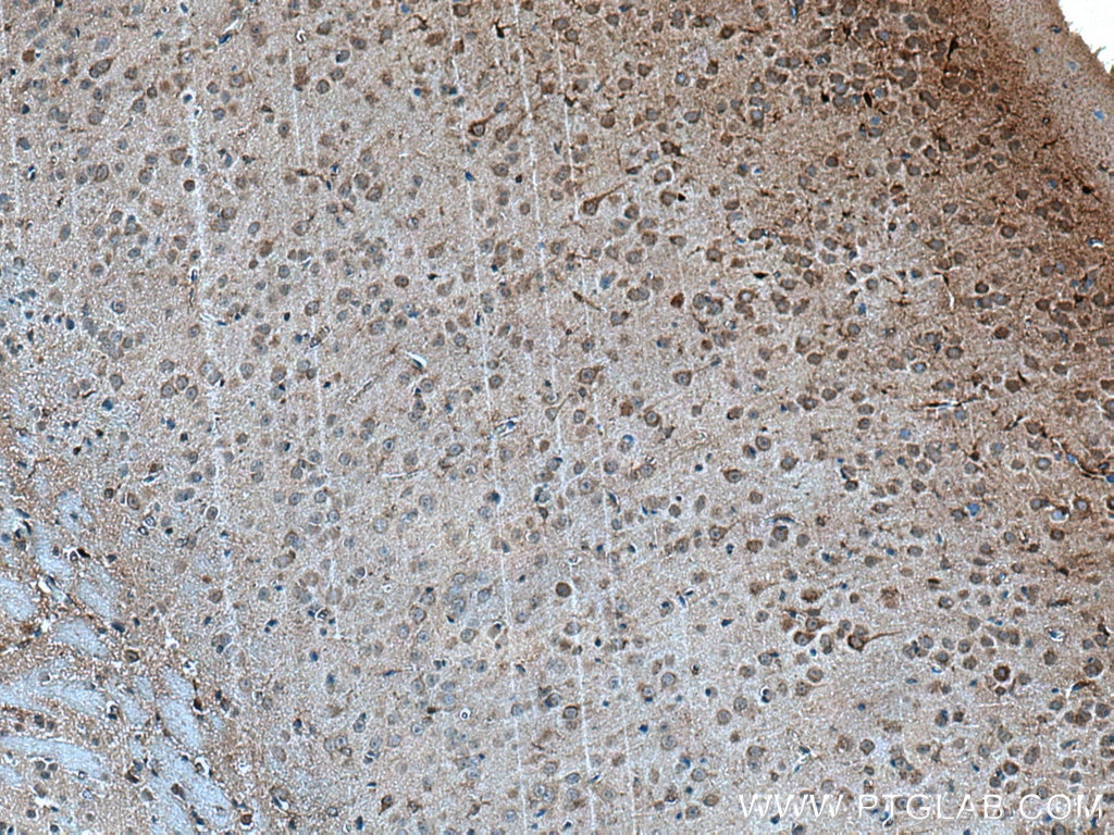 Immunohistochemistry (IHC) staining of mouse brain tissue using FBXO2 Polyclonal antibody (14590-1-AP)