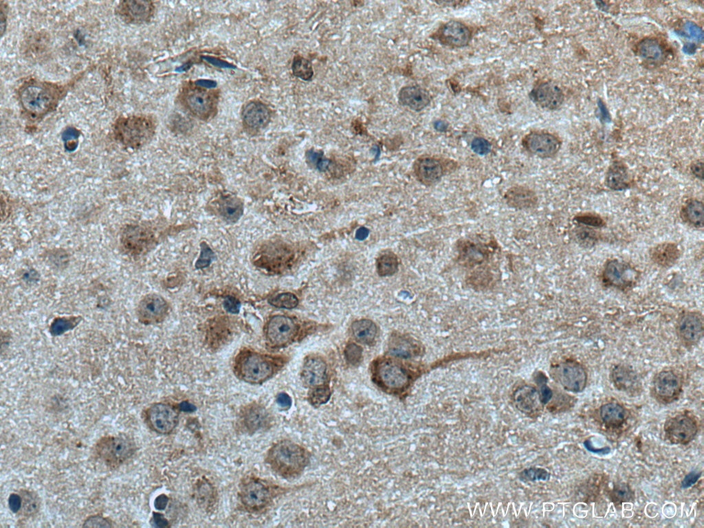 Immunohistochemistry (IHC) staining of mouse brain tissue using FBXO2 Polyclonal antibody (14590-1-AP)