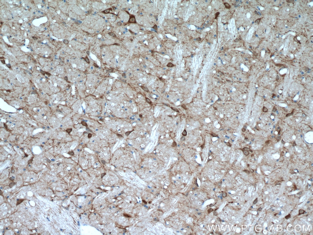 Immunohistochemistry (IHC) staining of rat brain tissue using FBXO2 Polyclonal antibody (14590-1-AP)