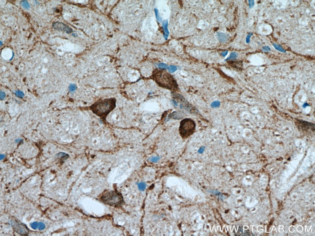 Immunohistochemistry (IHC) staining of rat brain tissue using FBXO2 Polyclonal antibody (14590-1-AP)
