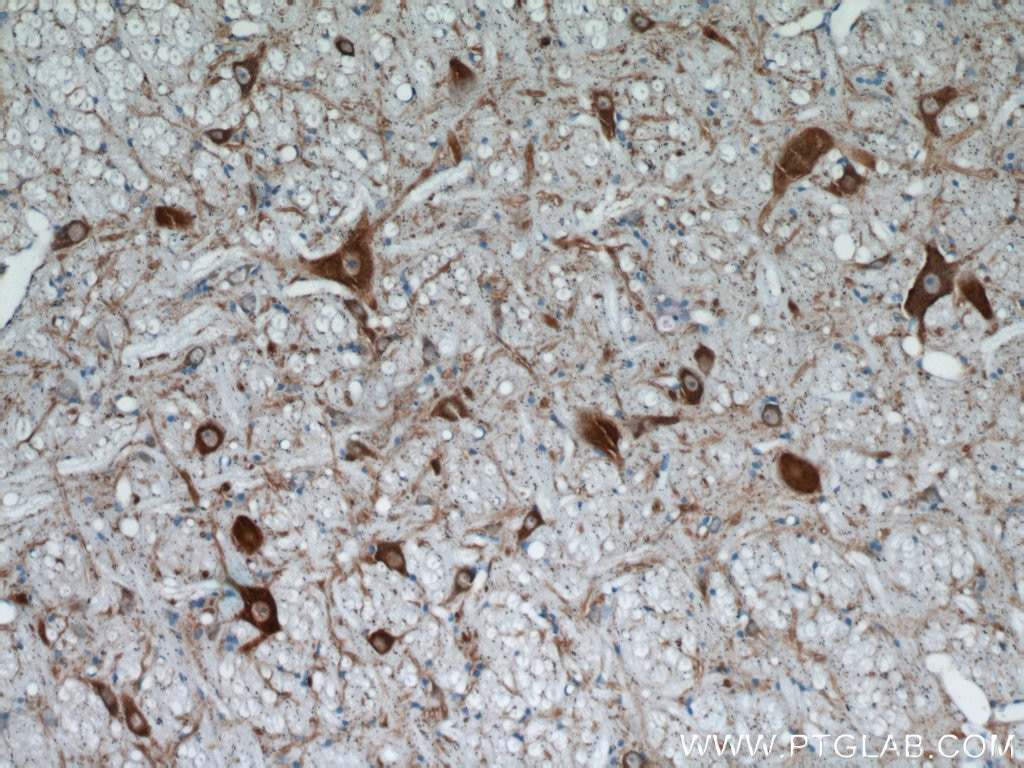 Immunohistochemistry (IHC) staining of rat cerebellum tissue using FBXO2 Polyclonal antibody (14590-1-AP)