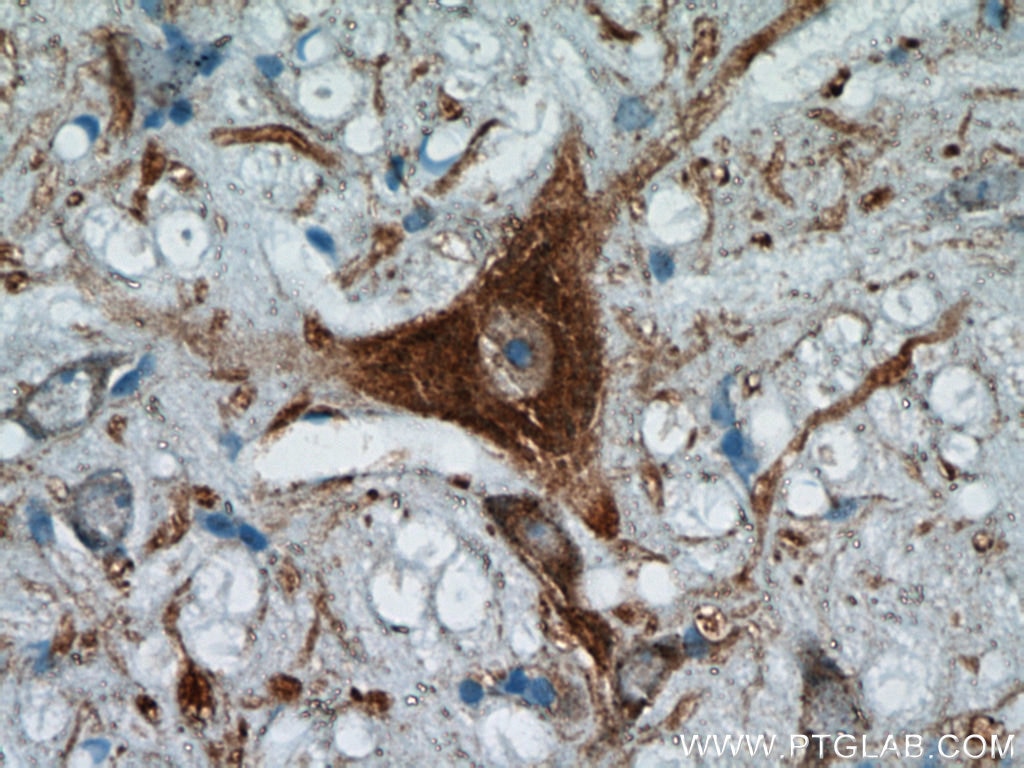 Immunohistochemistry (IHC) staining of rat cerebellum tissue using FBXO2 Polyclonal antibody (14590-1-AP)