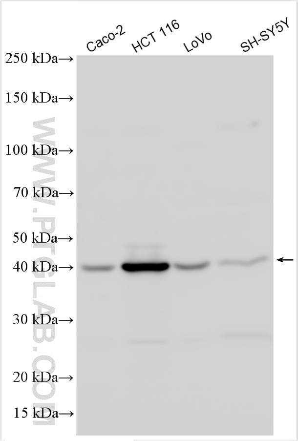 Western Blot (WB) analysis of various lysates using FBXO2 Polyclonal antibody (14590-1-AP)
