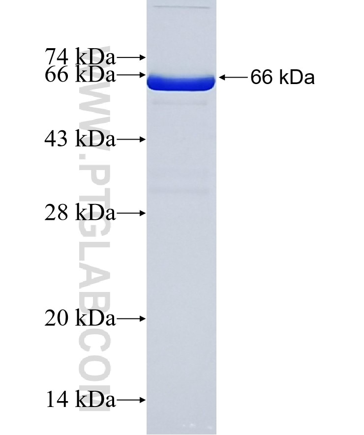 FBXO2 fusion protein Ag6122 SDS-PAGE