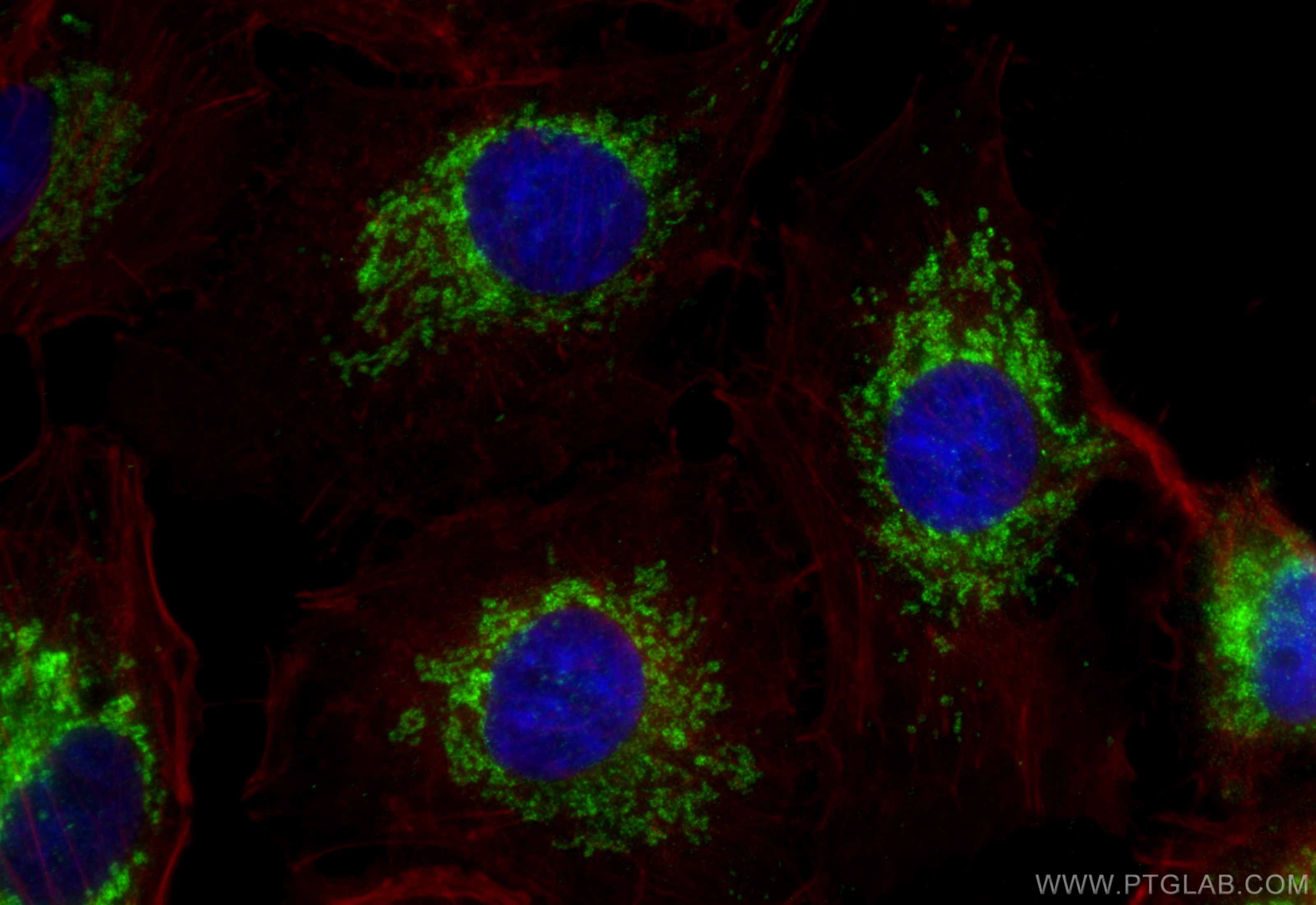 Immunofluorescence (IF) / fluorescent staining of A549 cells using FBXO21 Polyclonal antibody (17648-1-AP)