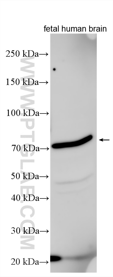Western Blot (WB) analysis of various lysates using FBXO21 Polyclonal antibody (17648-1-AP)