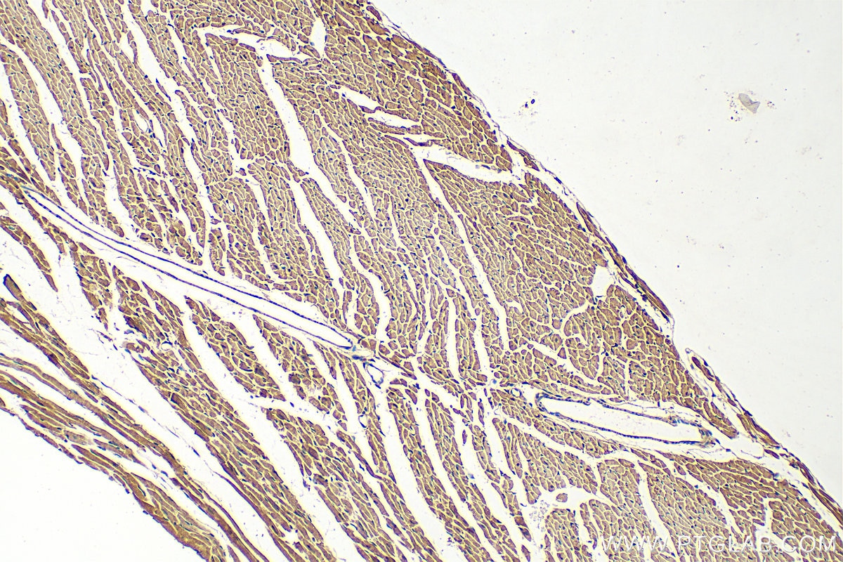 Immunohistochemistry (IHC) staining of mouse heart tissue using FBXO22 Polyclonal antibody (13606-1-AP)