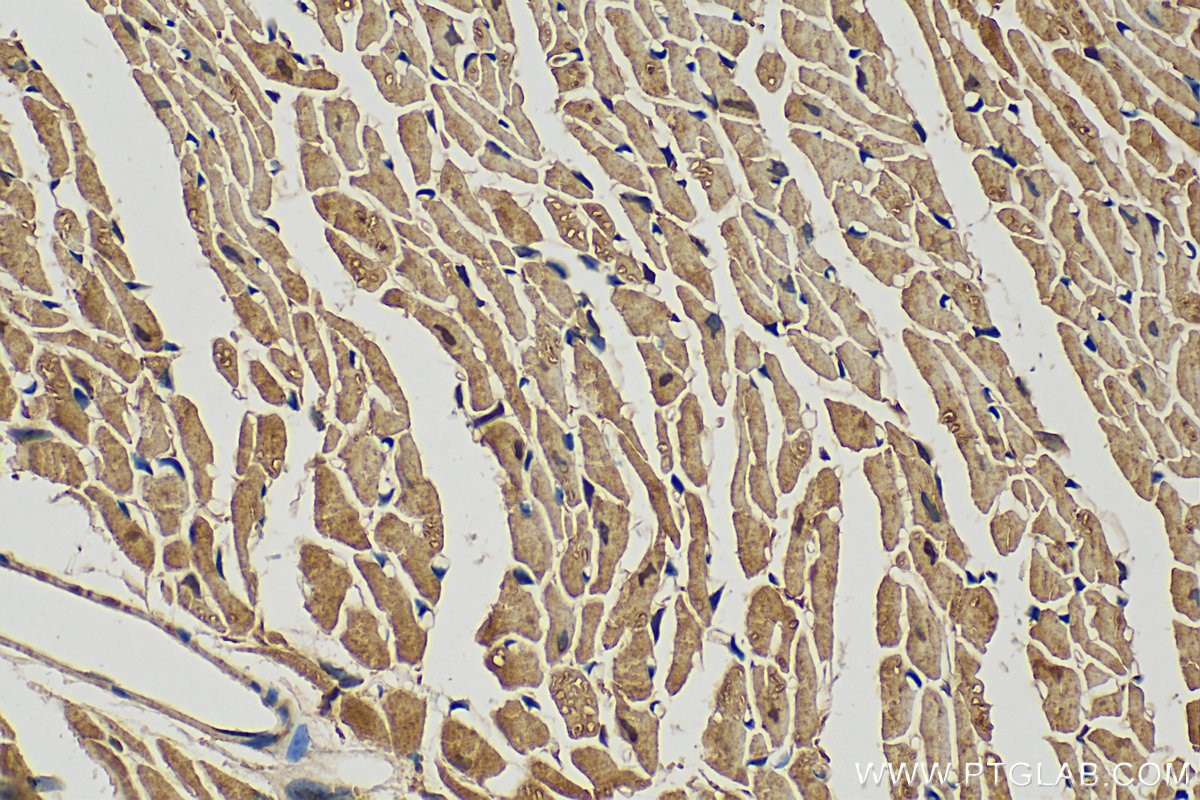 Immunohistochemistry (IHC) staining of mouse heart tissue using FBXO22 Polyclonal antibody (13606-1-AP)