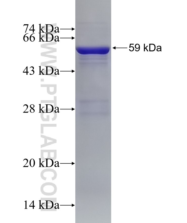 FBXO22 fusion protein Ag4485 SDS-PAGE
