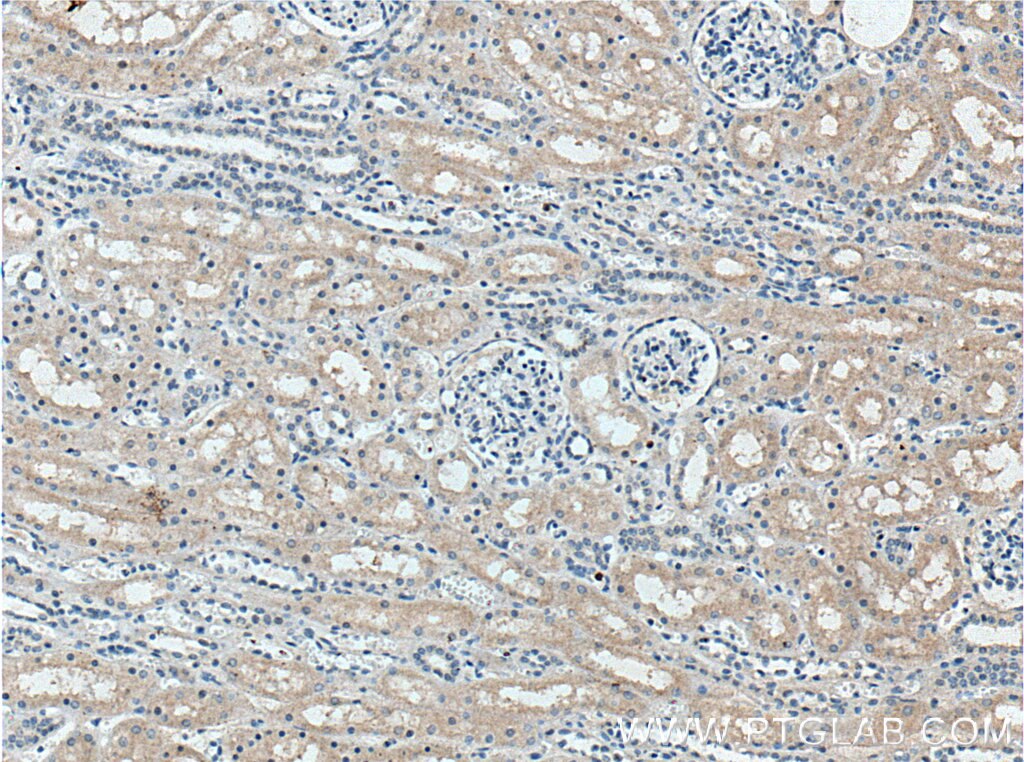 Immunohistochemistry (IHC) staining of human kidney tissue using FBXO27 Polyclonal antibody (14570-1-AP)
