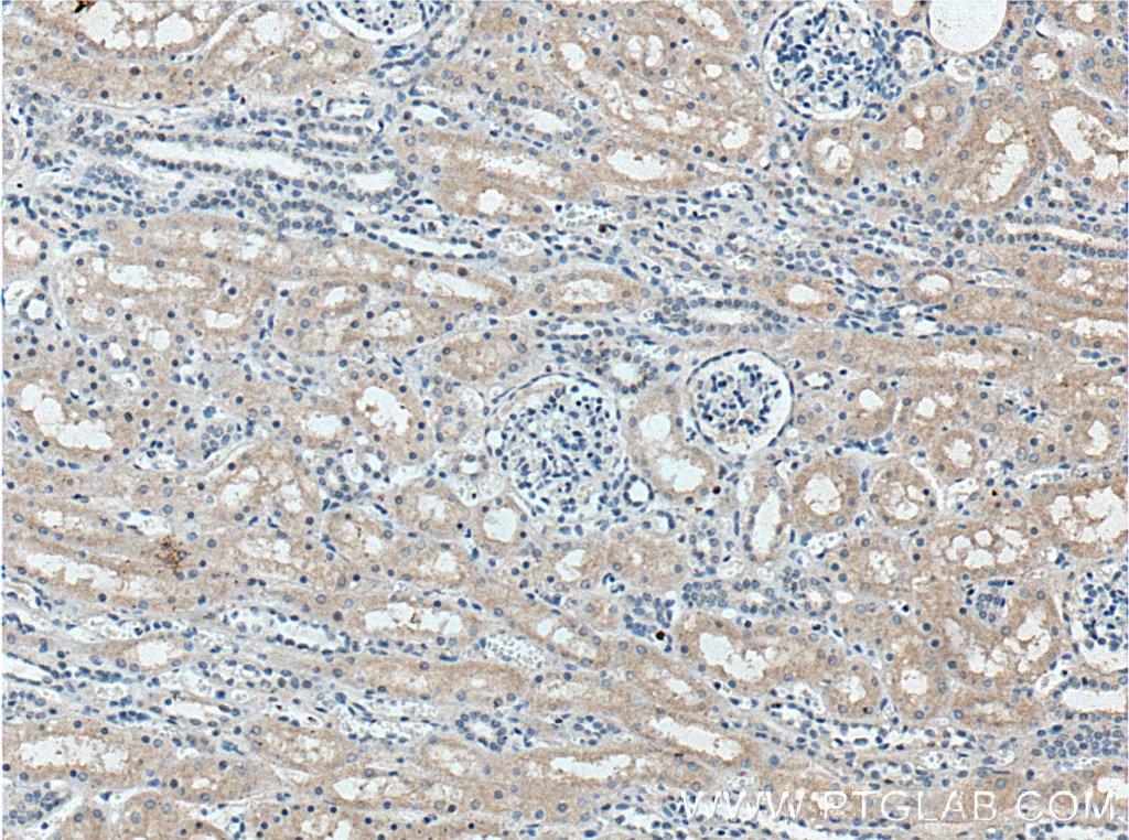 IHC staining of human kidney using 14570-1-AP