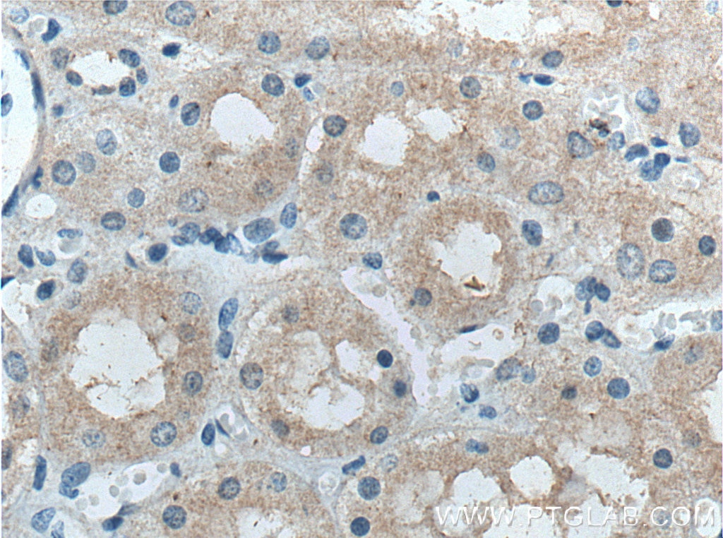 Immunohistochemistry (IHC) staining of human kidney tissue using FBXO27 Polyclonal antibody (14570-1-AP)