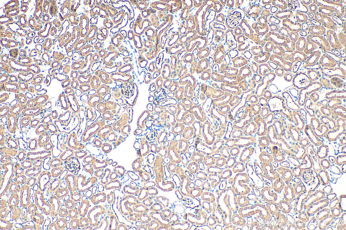 Immunohistochemistry (IHC) staining of mouse kidney tissue using FBXO27 Polyclonal antibody (14570-1-AP)